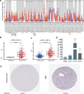 Exploring the prognostic value of HK3 and its association with immune infiltration in glioblastoma multiforme